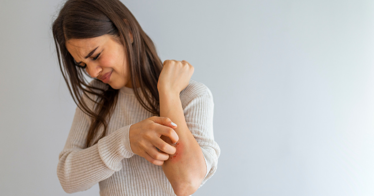 Desvendando a Psoríase e a Dermatite Seborreica: O que Precisa Saber